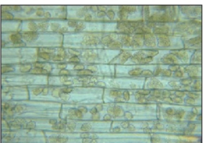 fungal zoospores fungal zoospores